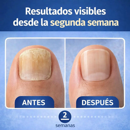 Parches NailRevive™ - Recupera uñas saludables mientras duermes
