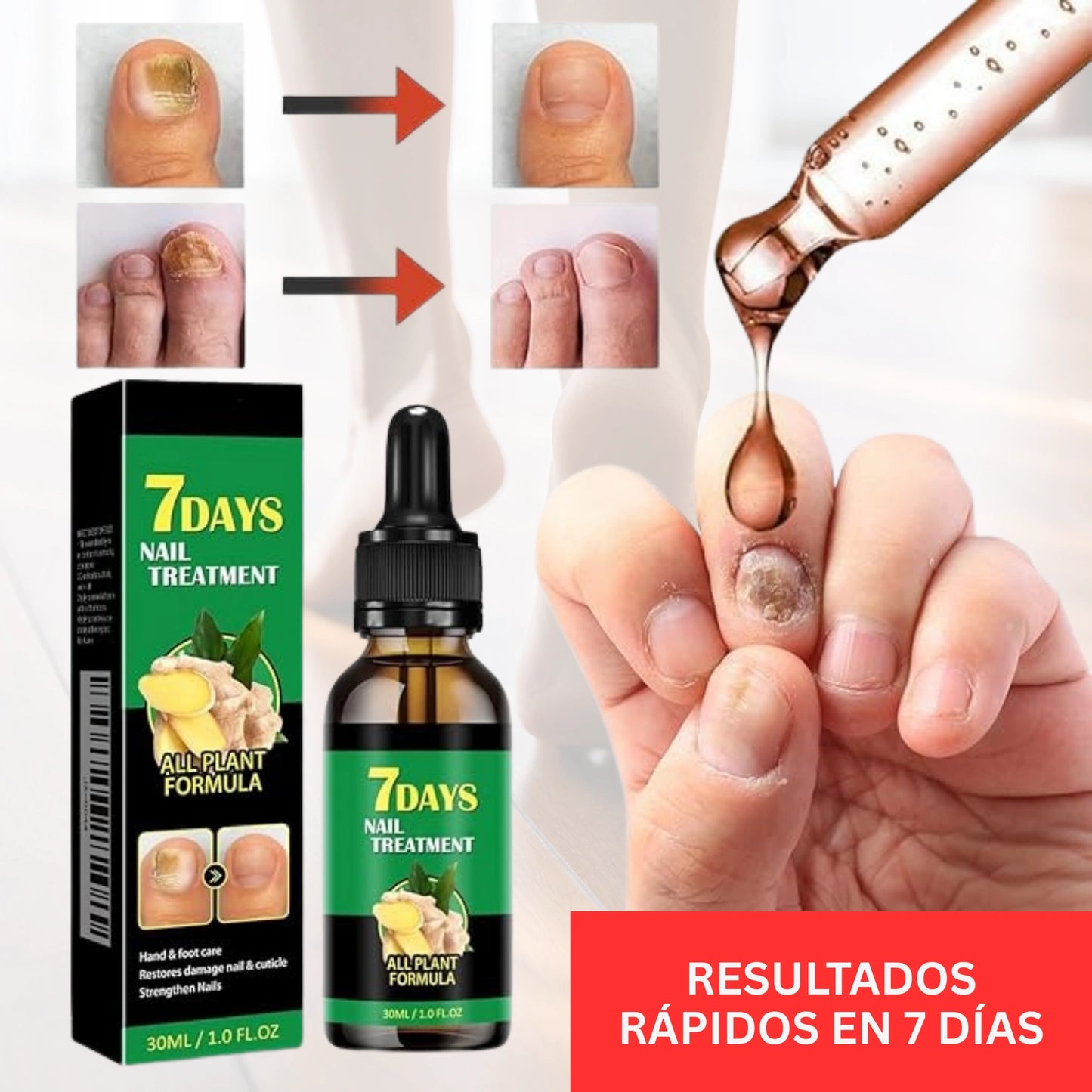 Serum Para Hongos - Uñas con mejor aspecto en 7 días con uso diario 100% NATURAL