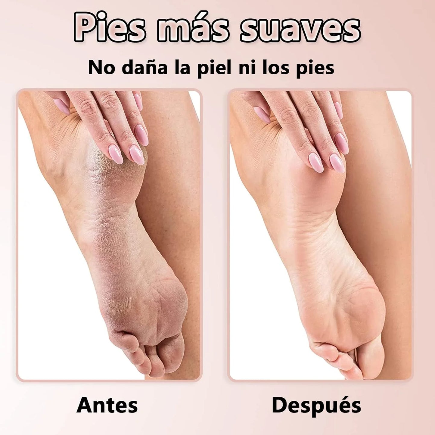 Limadora Electrica - LimaPro: Prepara tus pies para el sol y olvida los talones agrietados."